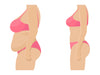 How to close your Diastasis Recti gap postpartum - 4 Exercises to try.