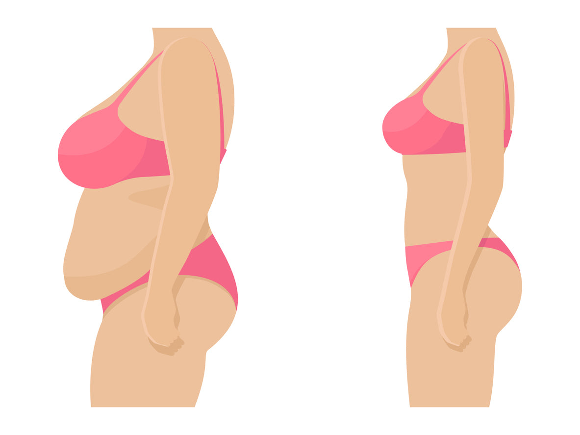 How to close your Diastasis Recti gap postpartum - 4 Exercises to